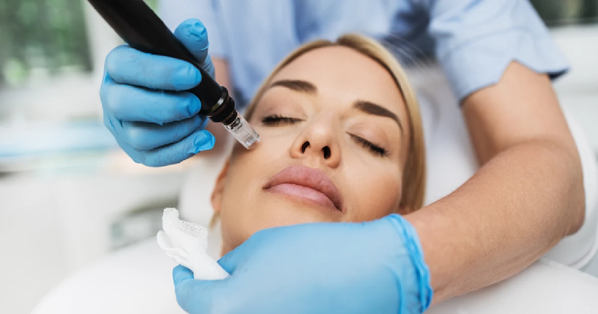Aesthetic specialist performing PRP microneedling on a woman’s face in Villa Rica, GA